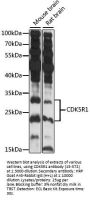 CDK5R1 Antibody