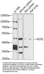 NCR1 Antibody