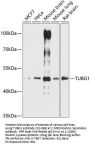 TUBG1 Antibody