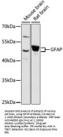 GFAP Antibody