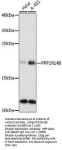 PPP1R14B Antibody
