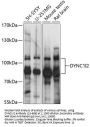 DYNC1I2 Antibody