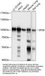 EPS8 Antibody
