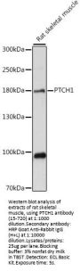 PTCH1 Antibody