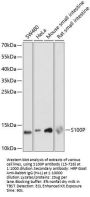S100P Antibody