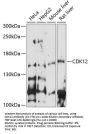 CDK12 Antibody