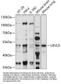 UEVLD Antibody