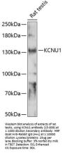 KCNU1 Antibody