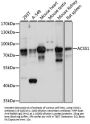 ACSS1 Antibody