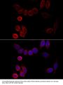CYP2A6 Antibody