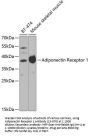 Adiponectin Receptor 1 Antibody