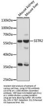 SSTR2 Antibody
