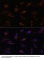TGFB1 Antibody