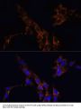 TGFB1 Antibody