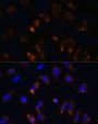 TGFB1 Antibody