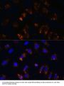 TGFB1 Antibody