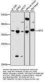 HEY2 Antibody