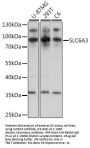 SLC6A3 Antibody