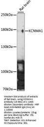 KCNMA1 Antibody