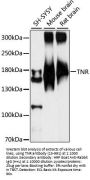 TNR Antibody