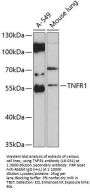 TNFR1 Antibody