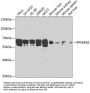 RPS6KB2 Antibody