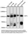 GIT1 Antibody, KO Validated