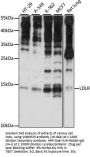 SNRNP25 Antibody