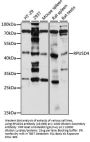 RPUSD4 Antibody