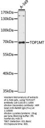 TOP1MT Antibody