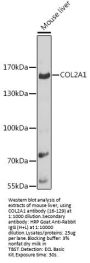 COL2A1 Antibody