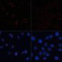 ACACA Antibody