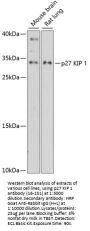 p27 KIP 1 Antibody