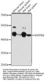 ENTPD6 Antibody
