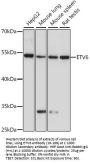 ETV6 Antibody