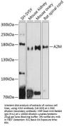 A2M Antibody
