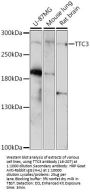 TTC3 Antibody