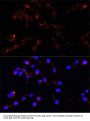 VDAC1 / Porin Antibody
