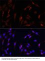 VDAC1 / Porin Antibody