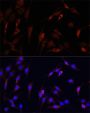 VDAC1 / Porin Antibody