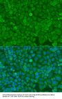 DICER1 Antibody