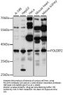 POLDIP2 Antibody