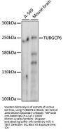 TUBGCP6 Antibody