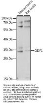ODF1 Antibody