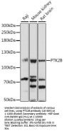 PTK2B Antibody