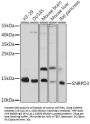 SNRPD3 Antibody