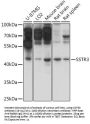 SSTR3 Antibody