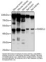 RHBDL1 Antibody