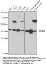 KCNK6 Antibody
