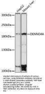 DENND4A Antibody